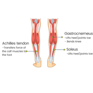 Torn Calf Muscles for Runner  Melbourne Sports Physiotherapy